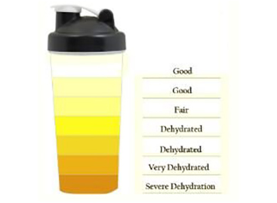 A jar showing urine colours